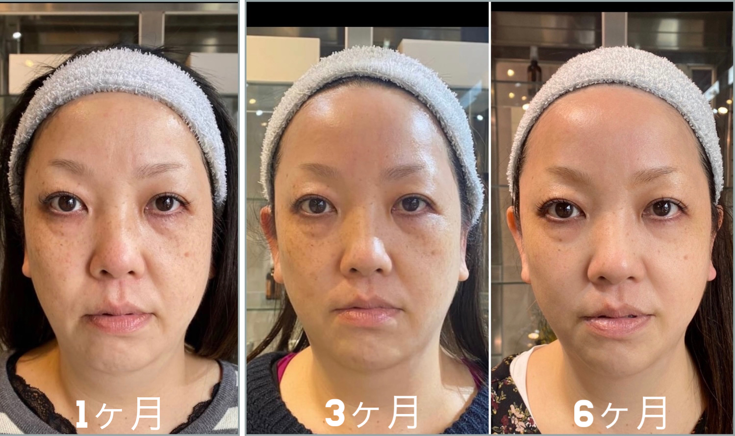 40歳からの肌質改善・小顔リフト専門店 整顔院®︎ – ４０歳からの肌質 ...